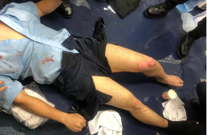 香港有暴徒在多处投掷汽油弹 一名警察被严重烧伤